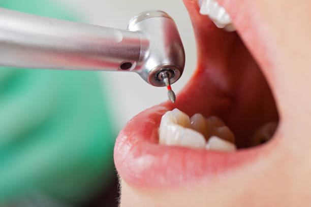 Best Mobile Emergency Dentist in Homer Glen, IL